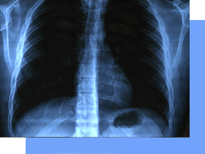 Médico especialista de pulmones
